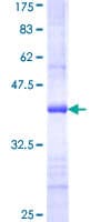 Human CRAT Protein (Recombinant GST, N-terminus)