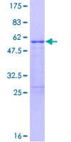 Human RNF207 Protein (Recombinant GST)