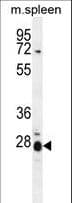 IL17B Antibody (aa39-66)