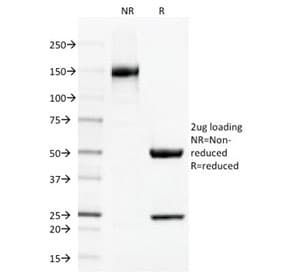 Monoclonal Mouse anti-Human THBD / CD141 / Thrombomodulin Antibody (clone THBD/1591, IHC, IF, WB)