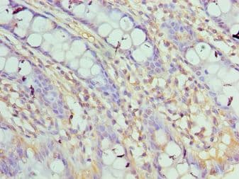 ASF1A Antibody (aa1-204)