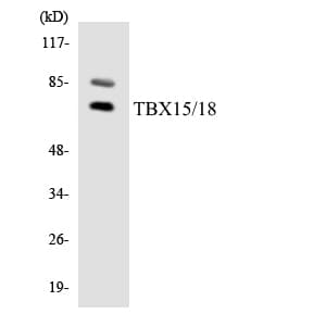 Polyclonal Rabbit anti-Human TBX15+18 Antibody (aa115-164, IHC, WB)