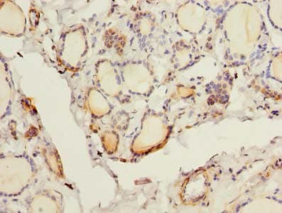 FYCO1 Antibody (Coiled-coil domain)