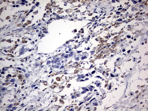 ALDP / ABCD1 Antibody (aa508-745, clone OTI4E2)