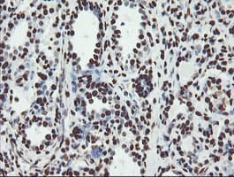 NONO / P54NRB Antibody (clone OTI2C9)