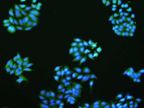 VMA21 / XMEA Antibody