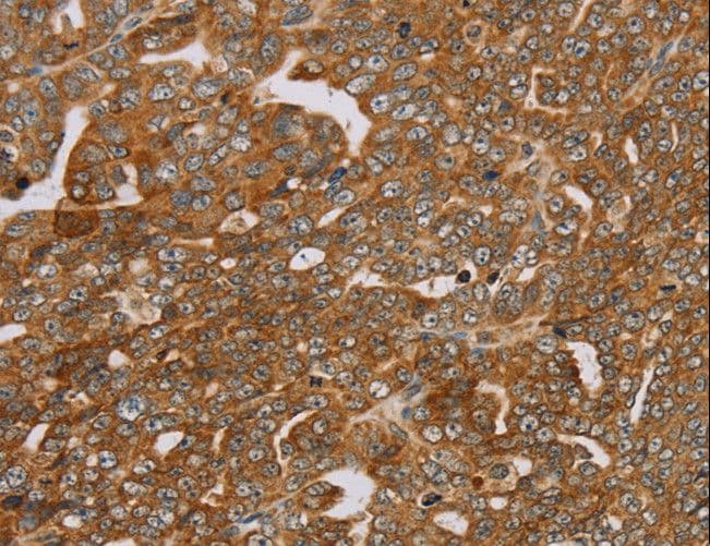 Polyclonal Rabbit anti-Human PLEKHG6 Antibody (IHC, WB)