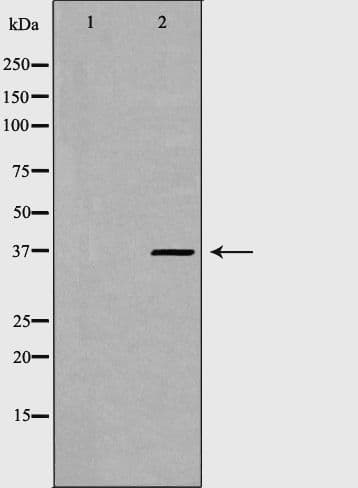 PSMD7 / MOV34 Antibody