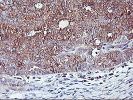 PFDN6 / HKE2 Antibody (clone OTI4E10)
