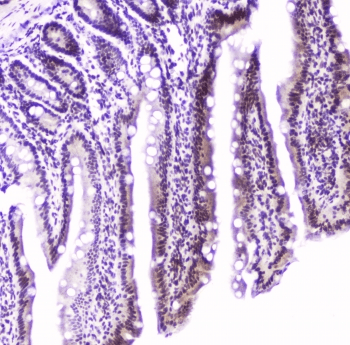Polyclonal Rabbit anti-Mouse MEF2C Antibody (IHC, WB)