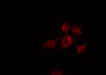 Polyclonal Rabbit anti-Human EPHB2 / EPH Receptor B2 Antibody (IF, WB)