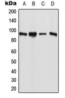 Polyclonal Rabbit anti-Human ESCO1 / ECO1 Antibody (N-Terminus, IHC, WB)