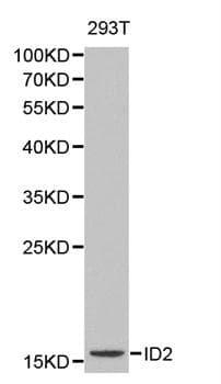 Polyclonal Rabbit anti-Human ID2 Antibody (IHC, WB)