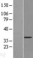UPRT Protein (Over-Expression Lysate Myc-DDK (Flag))