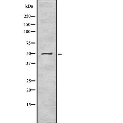 PNLIP / PL / Pancreatic Lipase Antibody