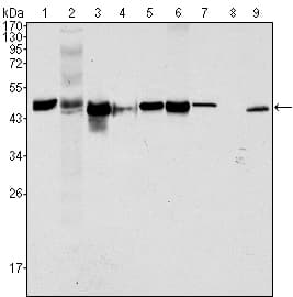 IHC-plus™ Monoclonal Mouse anti-Human KRT18 / CK18 / Cytokeratin 18 Antibody (clone 4D11E4, IHC, WB)
