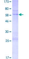 Human TRADD Protein (Recombinant GST)