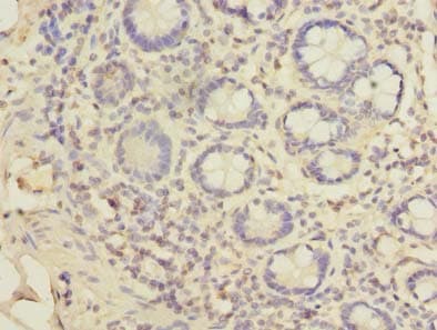Polyclonal Rabbit anti-Human TSSC1 Antibody (IHC)