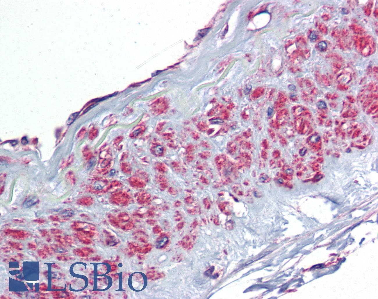 TGFBI Antibody (aa601-650)