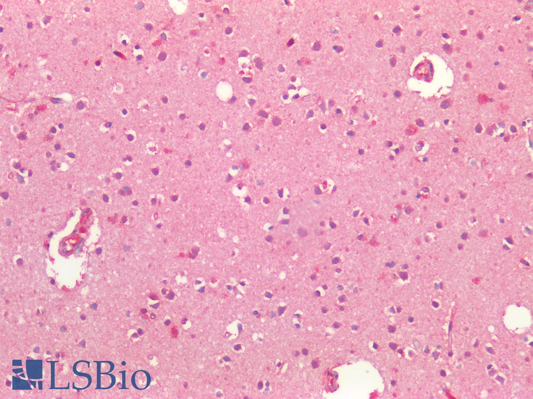 IHC-plus™ SLC27A1 / FATP Antibody