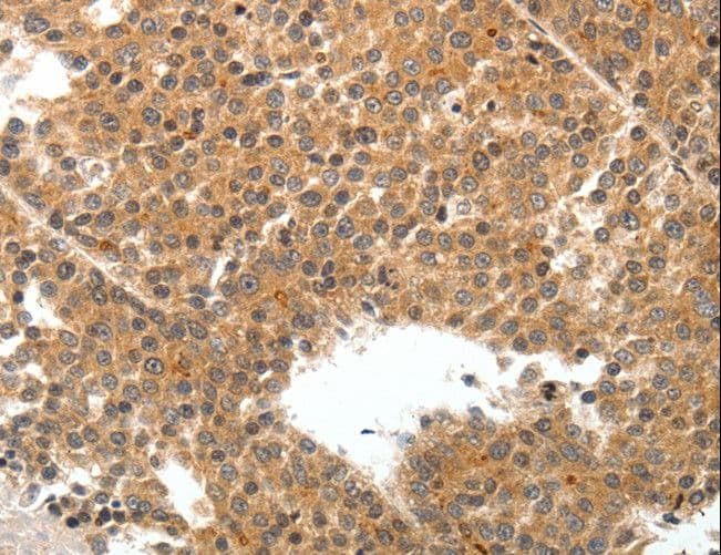 Polyclonal Rabbit anti-Human TEK / TIE2 Antibody (IHC)
