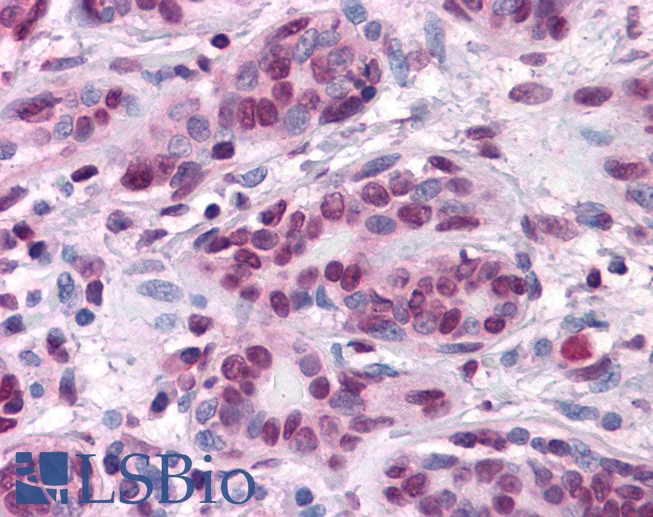IHC-plus™ CTNNB1 / Beta Catenin Antibody (clone 4D5)