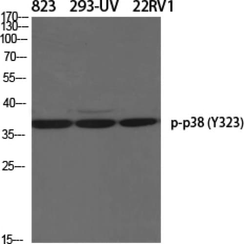 MAPK14 / p38 Antibody (260-340 aa)