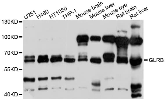 Polyclonal Rabbit anti-Human Spastic / GLRB Antibody (WB)
