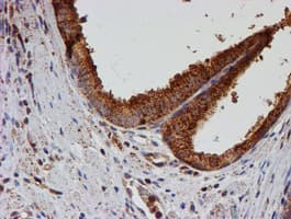 PSMB9 Antibody (clone OTI3H1)