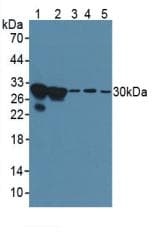 LGALS3 / Galectin 3 Antibody (aa1-250)