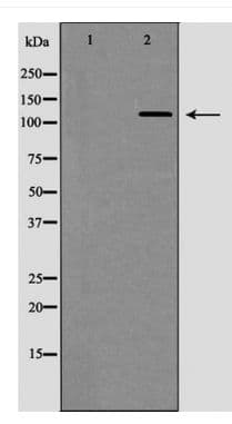 TERT / Telomerase Antibody