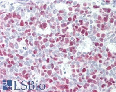 IHC-plus™ RB1 / Retinoblastoma / RB Antibody (aa196-245)