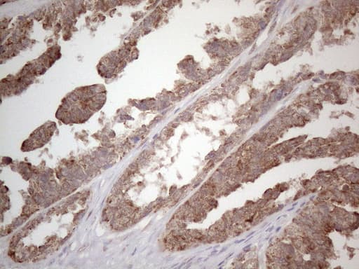 PODXL / Podocalyxin Antibody (aa32-461, clone OTI2C6)