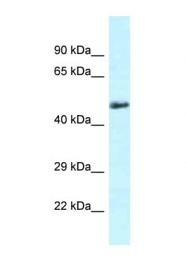 Polyclonal Rabbit anti-Mouse SLC1A4 / ASCT1 Antibody (C-Terminus, WB)
