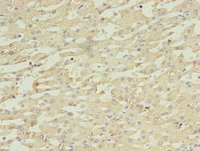DAPK2 / DAP Kinase 2 Antibody (aa222-370)