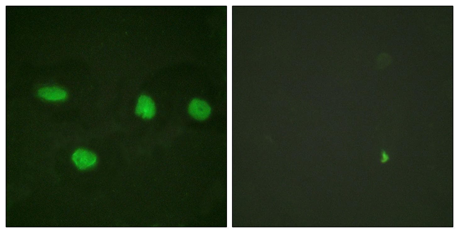 TP53BP1 / 53BP1 Antibody (p6)