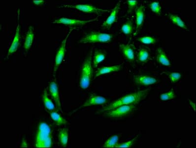 Polyclonal Rabbit anti-Human PAK4 Antibody (IHC)