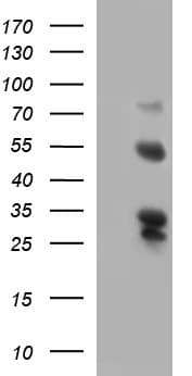 SMAD1 Antibody (clone OTI1C2)
