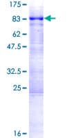 Human AAAS / Adracalin Protein (Recombinant GST)