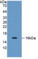 GHRH Antibody (aa20-103)
