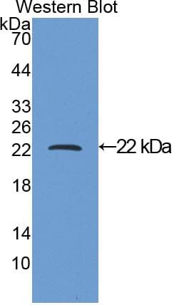 PTHLH / PTHRP Antibody (aa37-177)