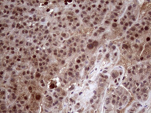 AMDHD1 Antibody (clone OTI1D4)