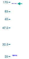 Human DBN1 / Drebrin Protein (Recombinant GST)