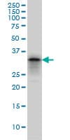 PHOX2A Antibody (clone 4F6)