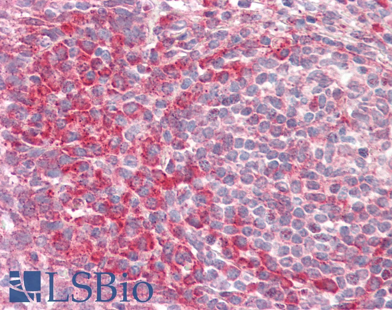 IHC-plus™ PEX13 Antibody
