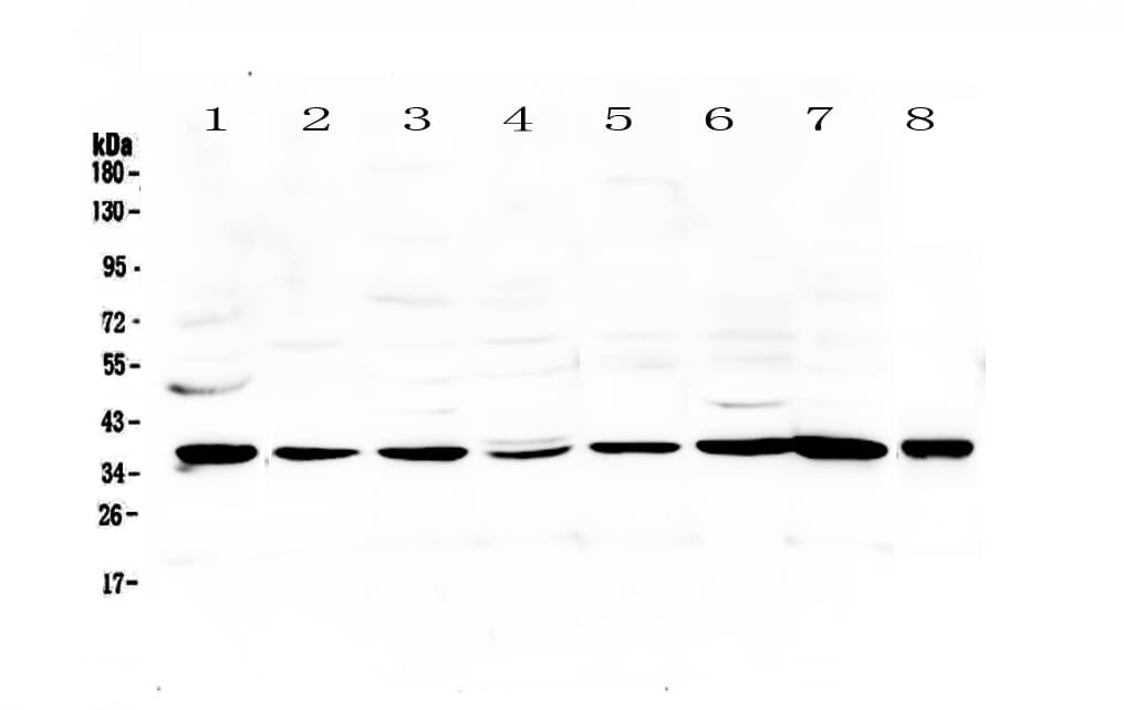 THPO / TPO / Thrombopoietin Antibody