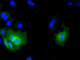 ACAT2 Antibody (clone OTI5C9, Carrier-free)
