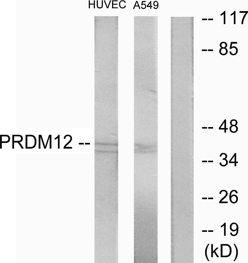 Polyclonal Rabbit anti-Human PRDM12 Antibody (WB)