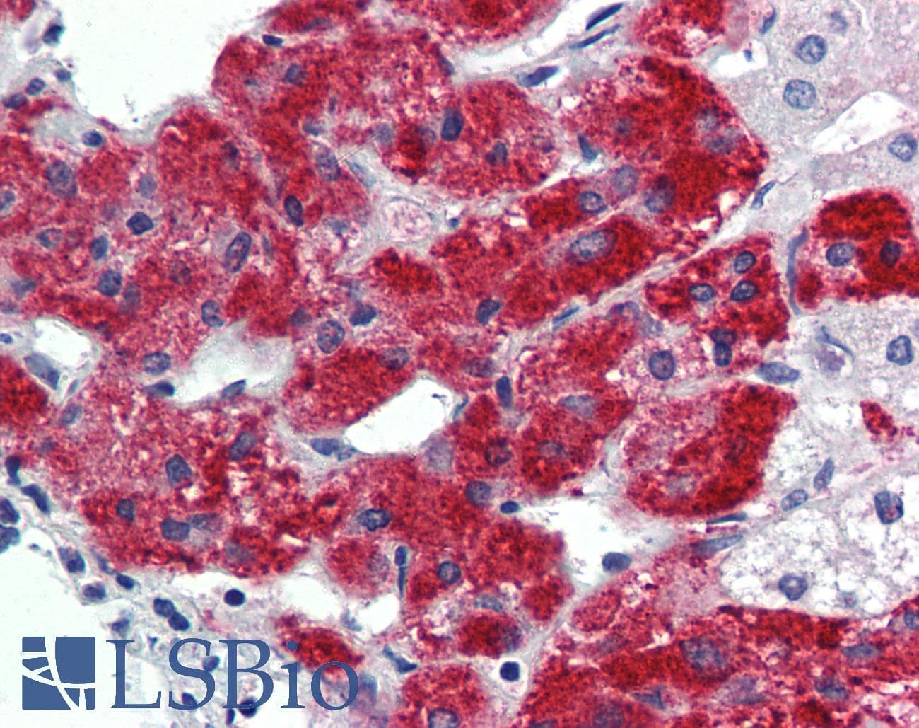 Polyclonal Rabbit anti-Human TBX20 Antibody (N-Terminus, IHC, WB)