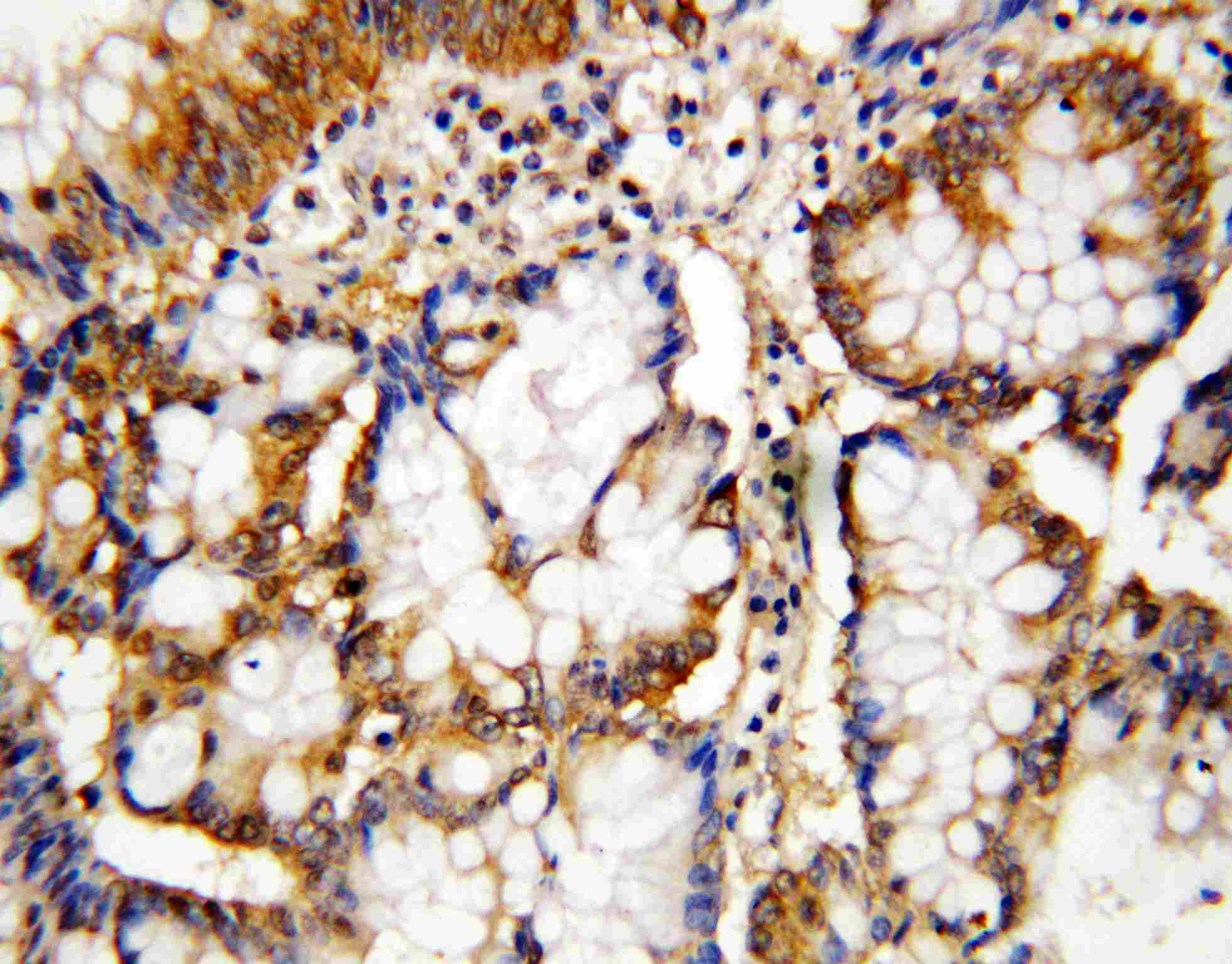 CASP10 / Caspase 10 Antibody (aa220-236)